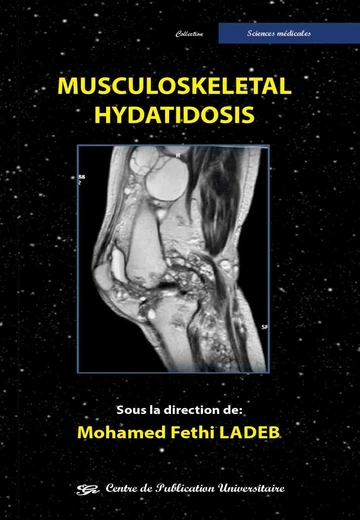 Cover of Musculoskeletal Hydatidosis